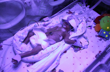 Premature black baby in ICU using breathing assistance devices