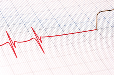 Electrocardiogram showing a heartbeat and then a flatline indicating death